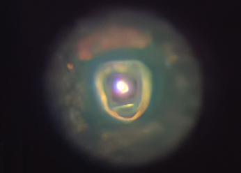 Eskimo Nebula